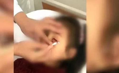 眼内有异物感是什么原因,医院如何取出眼内异物