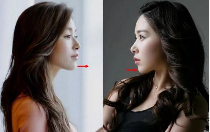 鼻子健康对五官的重要性,鼻子是决定颜值上限的部位