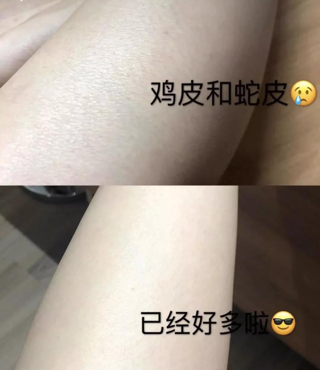 保湿的身体乳公认最好用,抹了身体乳皮肤干燥起皮