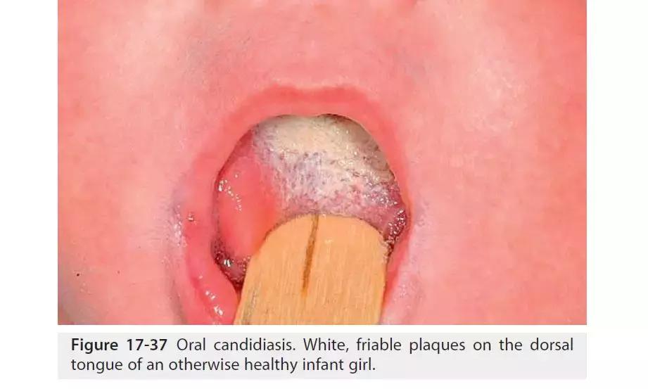 新生儿皮肤问题大全一览表,新生儿常见八大皮肤问题