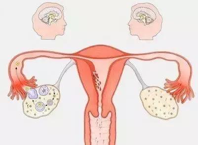 卵巢偏小是卵巢早衰的现象吗,卵巢早衰的6个原因