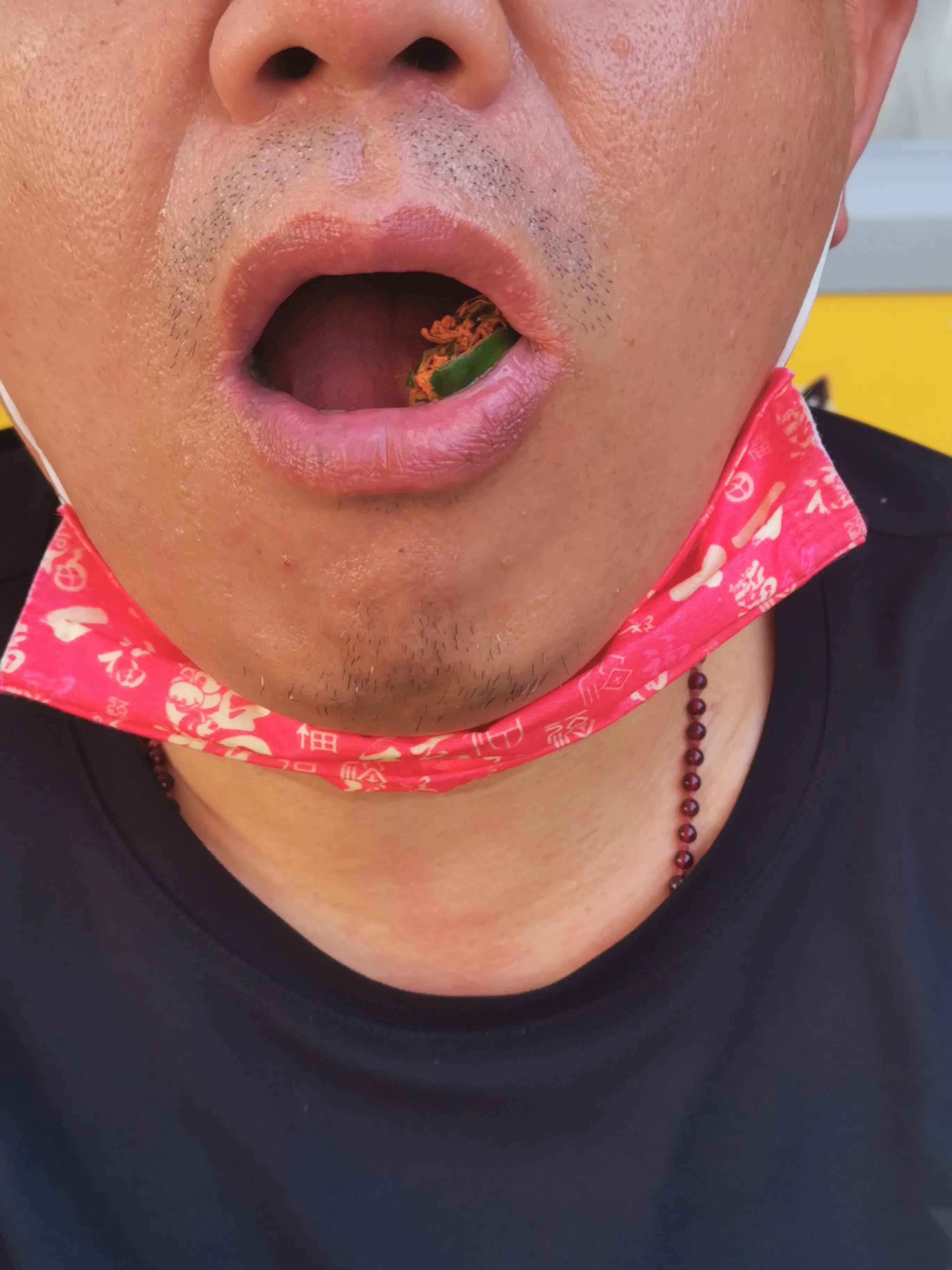 吃槟榔之后怎么恢复,吃槟榔之后口腔能恢复吗