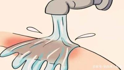 小孩子不小心烫伤怎么办,如果小孩被烫伤了怎么办