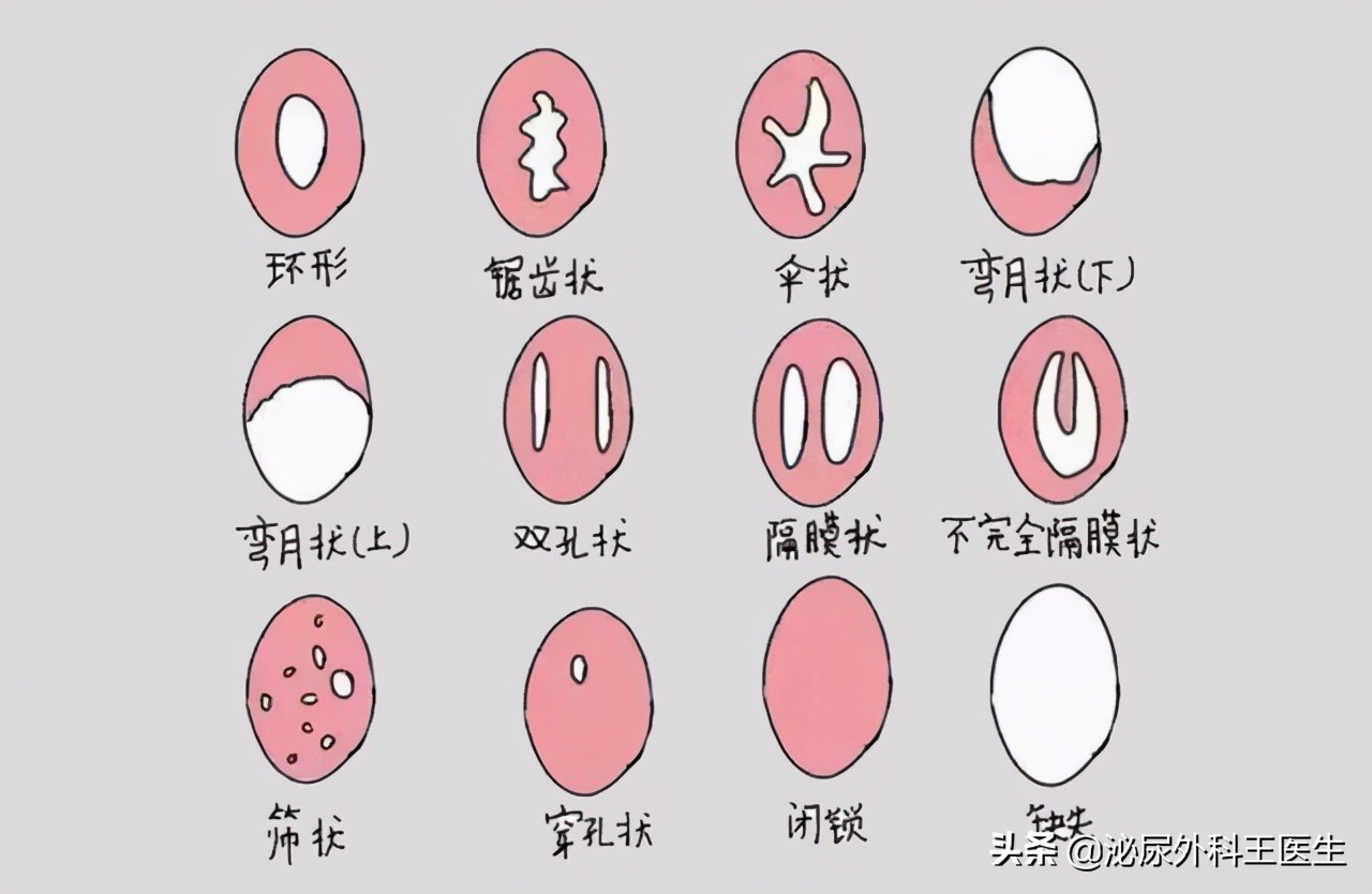 什么是阴式b超检查时有什么感觉,阴式b超检查前注意事项