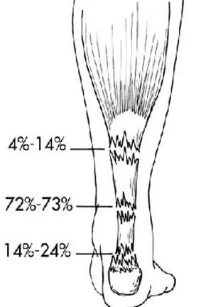 猛于虎伤病季后赛,勇士对猛龙汤普森受伤片段