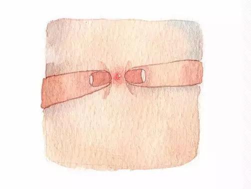 闭口性粉刺怎么去除最快,闭口性粉刺怎么彻底去除