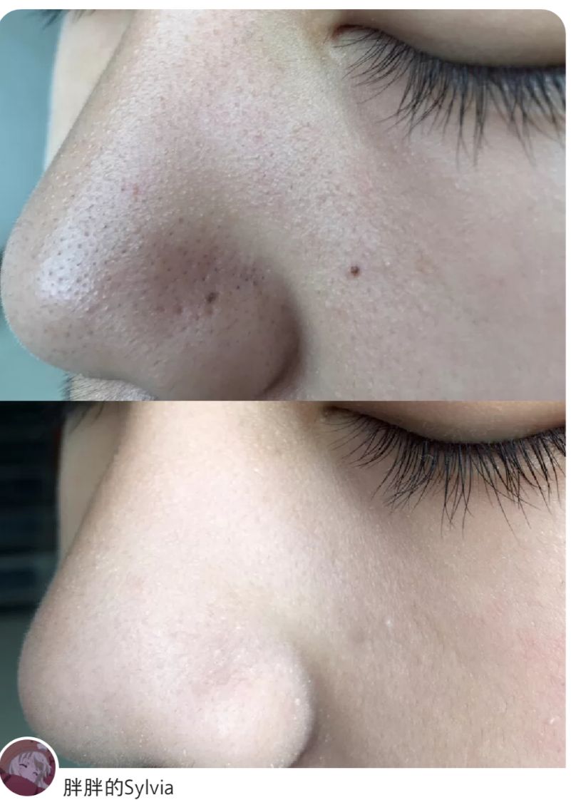 油皮透明粉饼真实测评,混合偏干皮肤干湿两用粉饼推荐