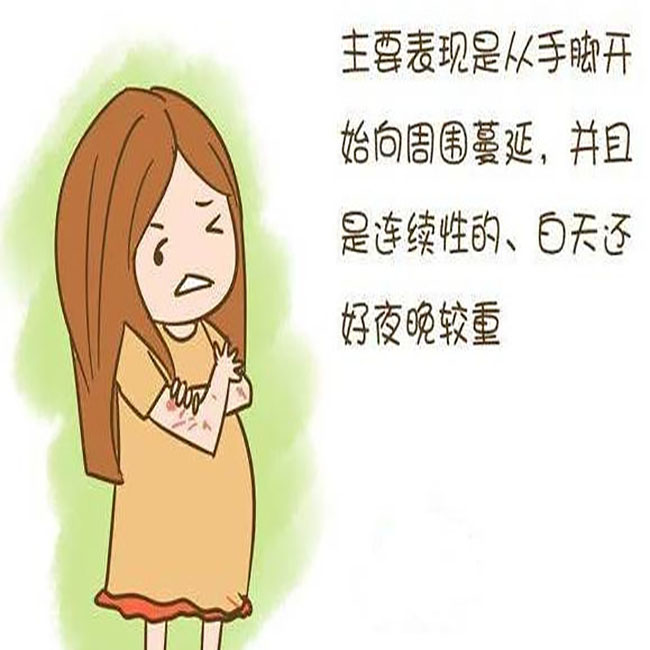 妇科炎症奇痒用什么涂抹,孕晚期肚皮奇痒无比