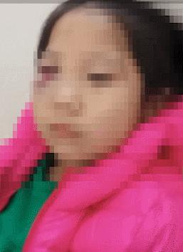 孩子被老师打的嘴巴出血,小学生被老师把耳朵打破皮