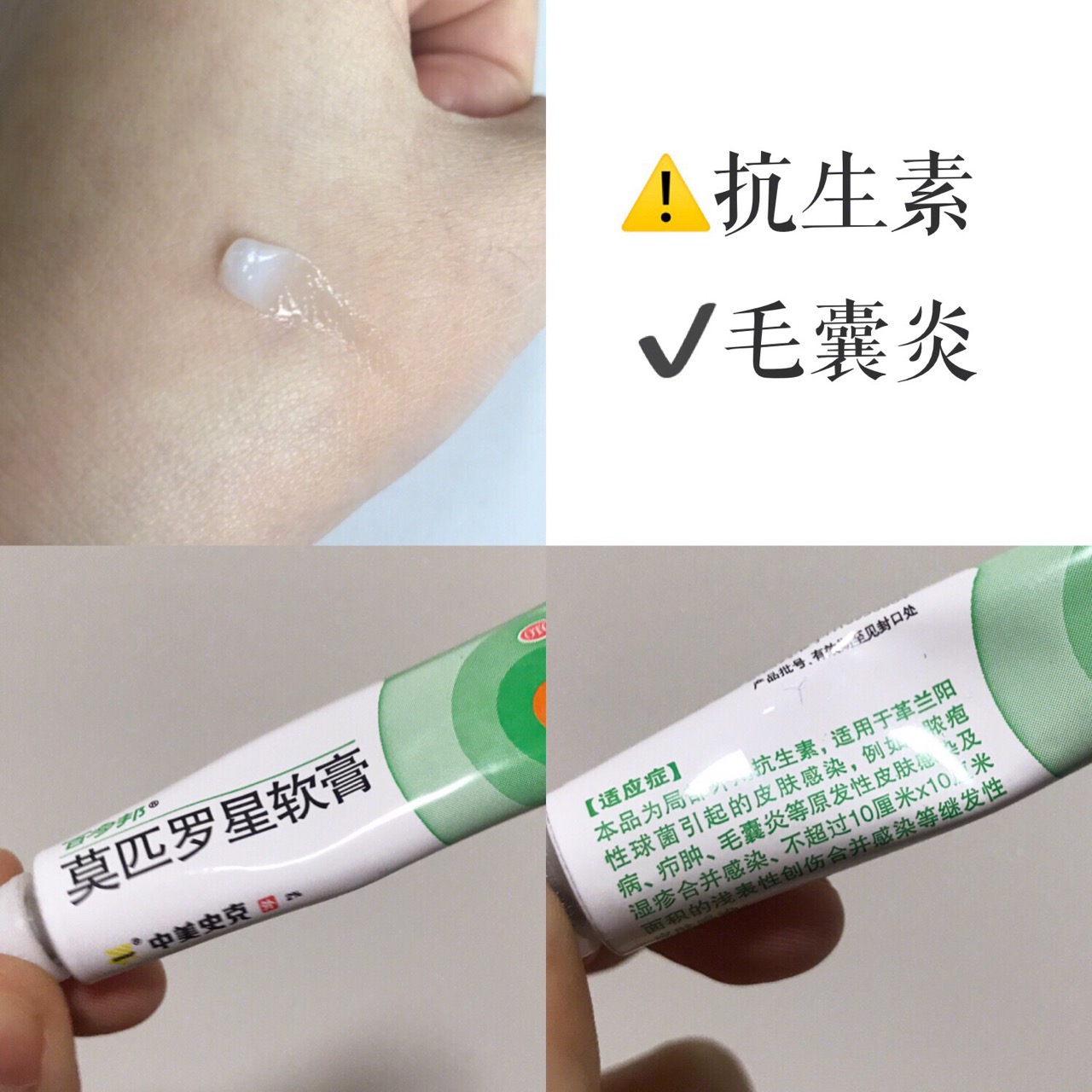 女孩子必用的祛痘神器,公认最好的祛痘药