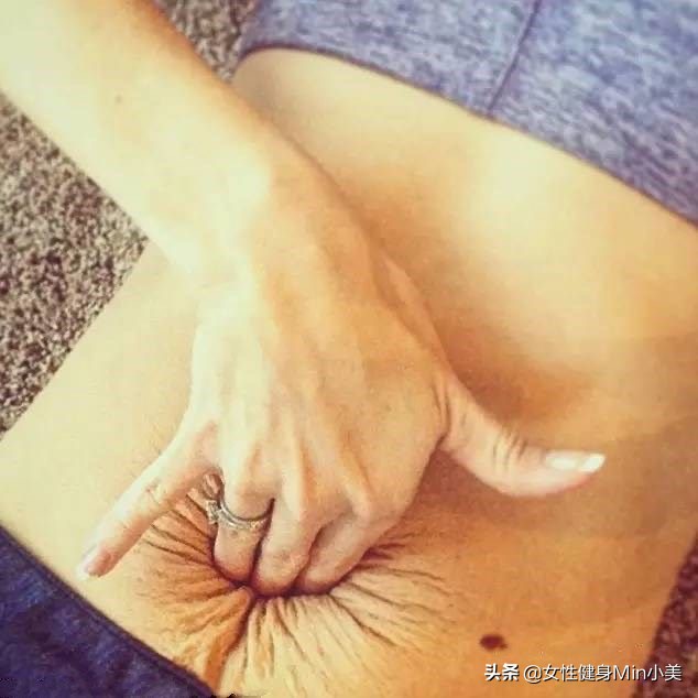 产后腹直肌没有分离怎么瘦肚子,产后还是瘦不下来怎么回事