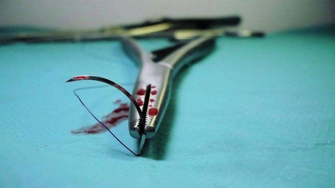 宫外孕成新晋孕产的四种习惯,宫外孕早期和先兆流产