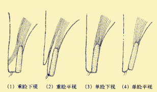 怎么让自己变成双眼皮不用做手术,怎样不做手术眼睛也能变成双眼皮