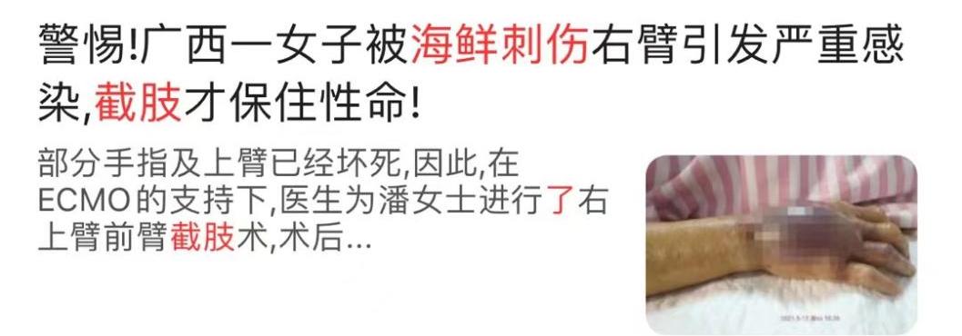 女子被鱼刺卡了喉咙,女子被鱼刺扎破