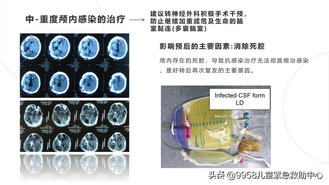 颅内感染康复治疗知识,小儿颅内感染的健康宣教