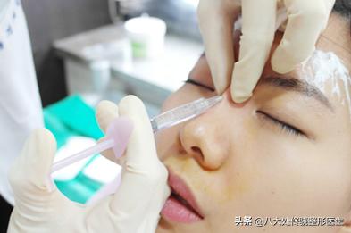 面部一枝花全靠鼻子当家,鼻子一针玻尿酸效果图