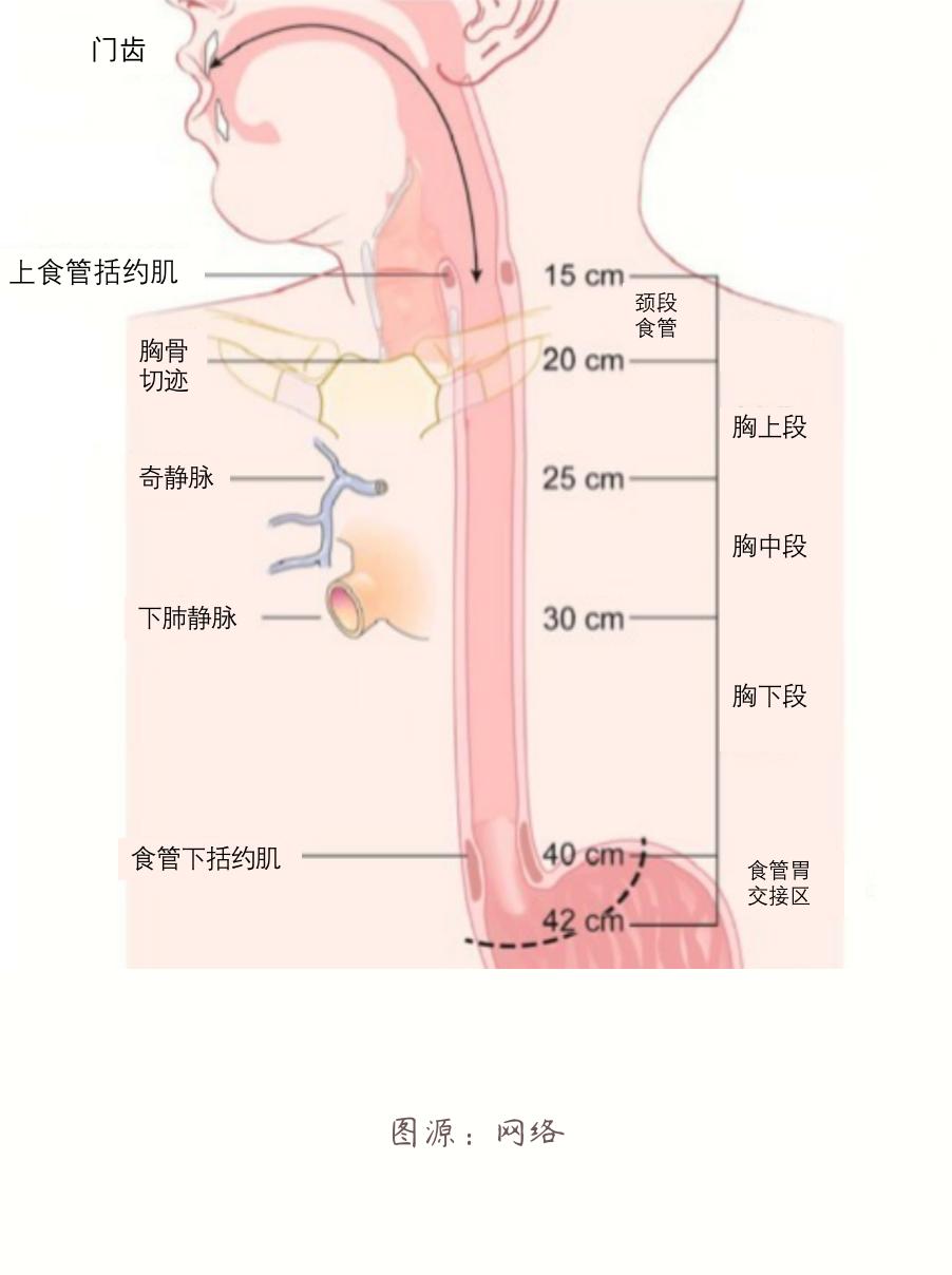 食管癌前病变esd手术能治愈吗,食管癌无法手术怎么办