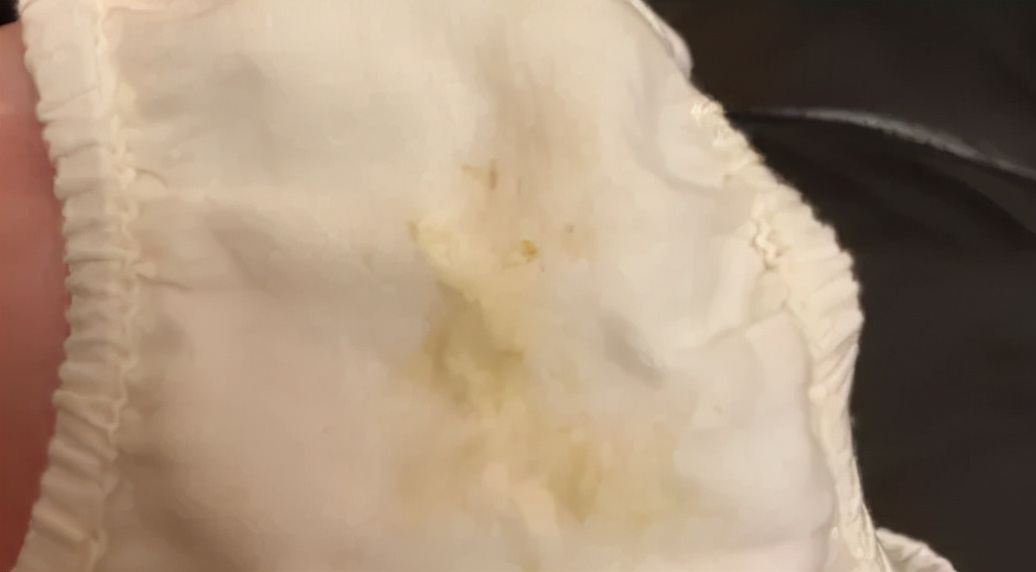 女宝宝裤头有血怎么回事,宝宝尿裤上有黄色分泌物