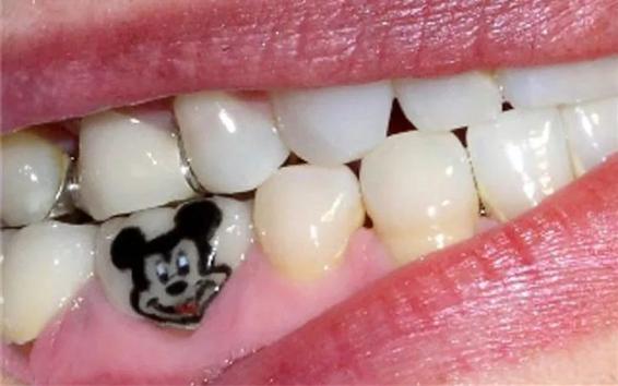 全球流行纹身,牙齿纹身图