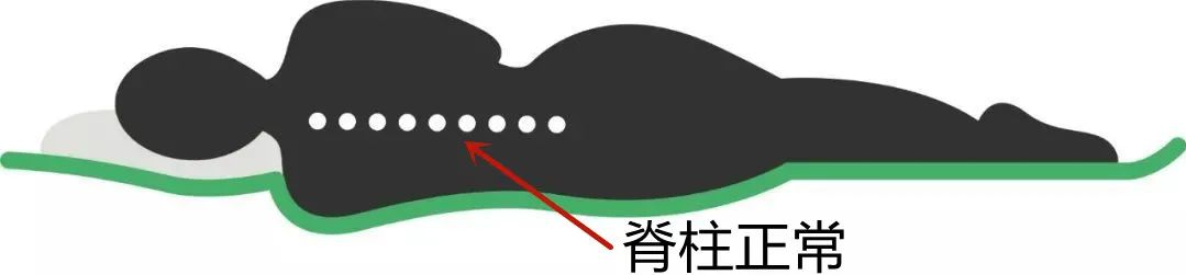 硬床好还是软包床好,腰椎间盘突出睡软床还是硬床垫好