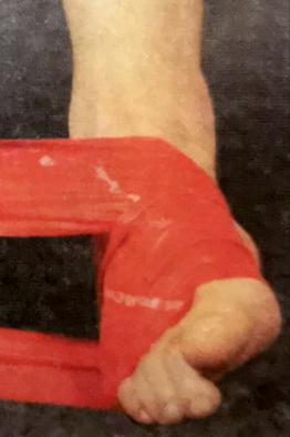 鞋子内侧磨损,鞋子后脚跟内侧磨损