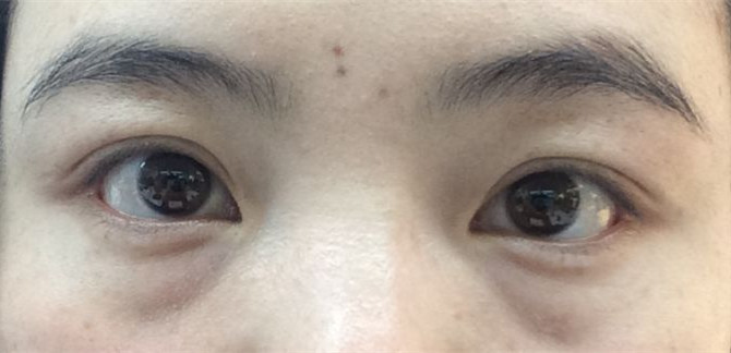 什么眼霜好用去眼纹,眼部用什么眼霜比较好