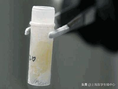 通过精子颜色可以看出精子质量吗,精子质量主要看哪几个指标