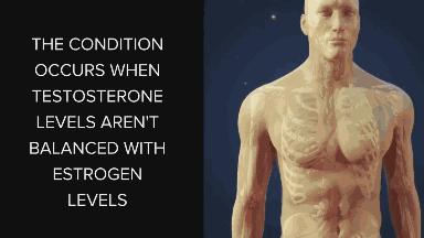 男生发育胸大怎么样锻炼,男的胸发育能不能缩小