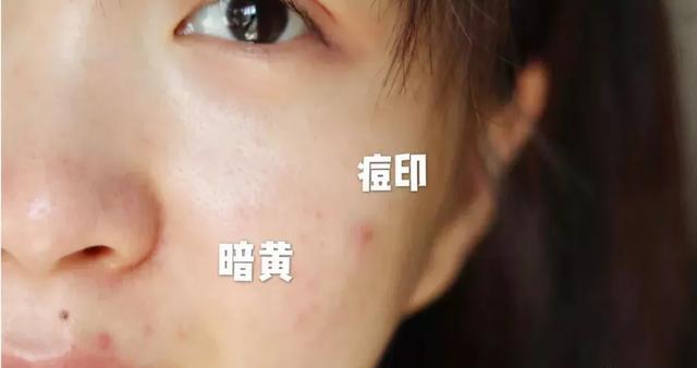 377美白成分分析,德国377美白成分