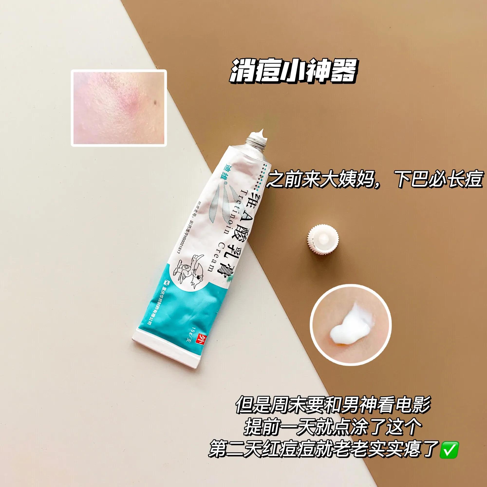 学生美白祛痘方法3天见效,学生党如何祛痘变白