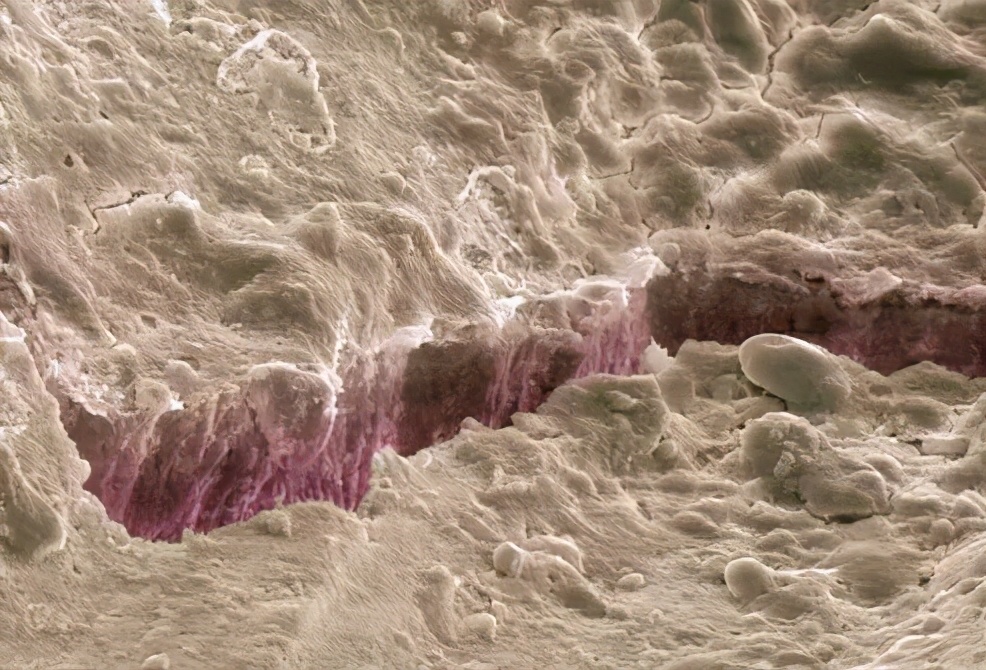 上海雅悦齿科,雅悦齿科种植牙