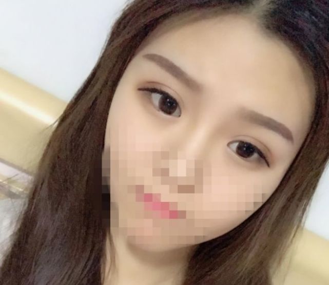 医生说我不适合做线雕,医生说我不适合做飞秒手术