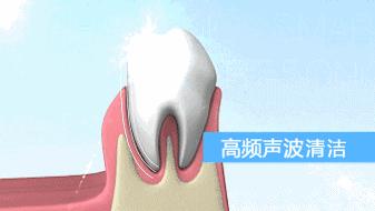 电动牙刷一般怎么充电 (电动牙刷一般怎么充电的)