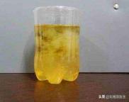 「免疫相关不良妊娠答疑解惑52」——妊娠期高血压疾病