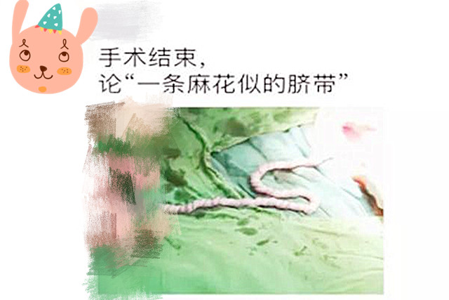 孕妇怀孕结果难产,怎么知道孕中晚期胎儿胎停