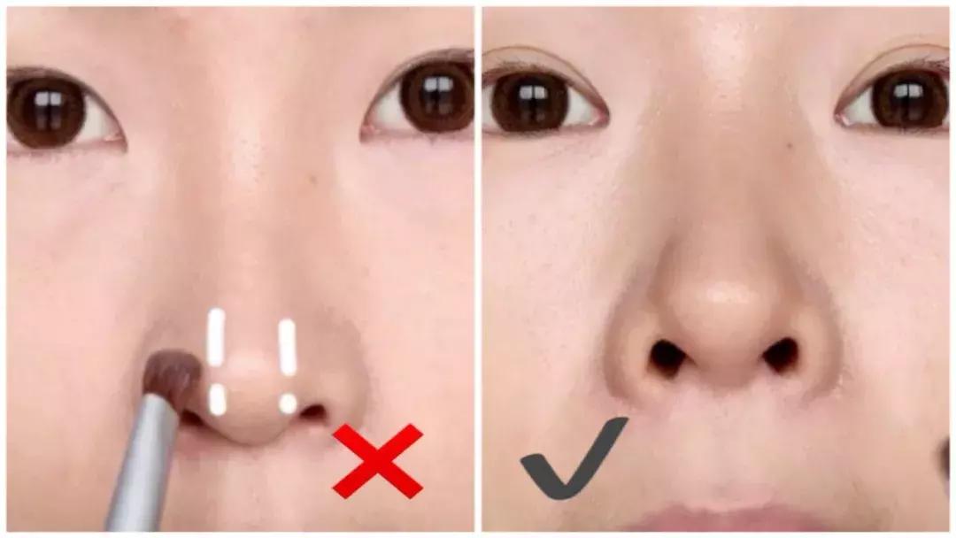 缩小鼻孔最简单有效的方法,怎么自由缩鼻孔