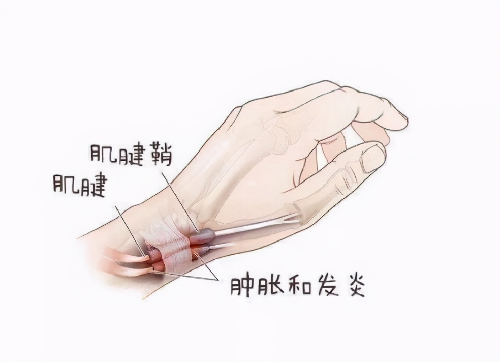 生孩子后容易衰老的特征,为何女性产后衰老那么快