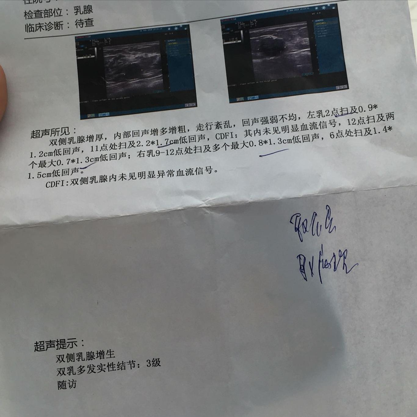 结节息肉囊肿增生哪个更容易癌变,结节囊肿增生息肉有什么区别