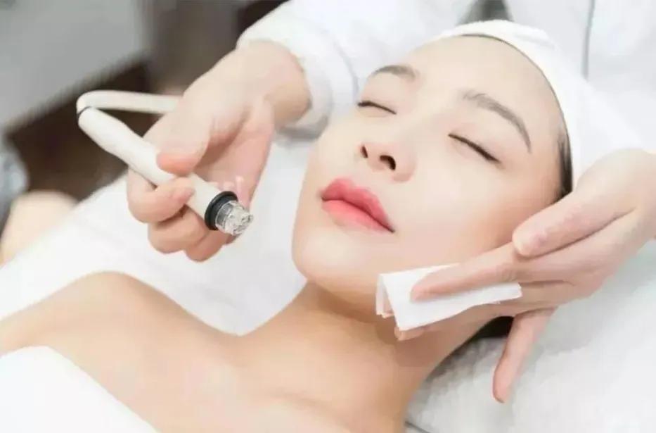 黑头除了用鼻贴还能怎么做,去黑头用洗面奶好还是黑头贴好