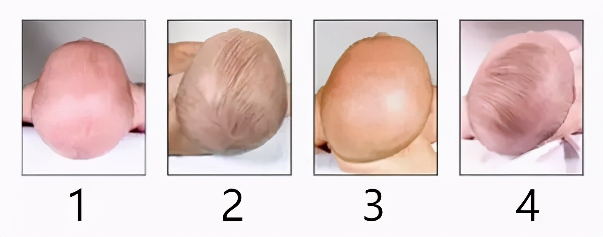 儿童定型枕有必要买吗,儿童定型枕有必要吗