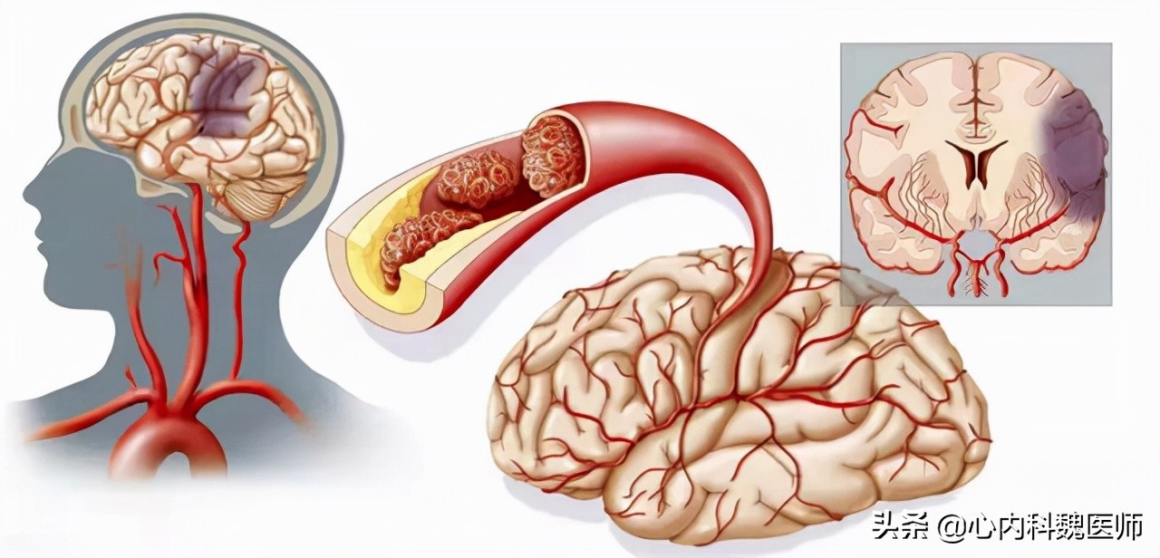 美国叶酸大量下架是真的吗,关于美国人强行补叶酸的问题