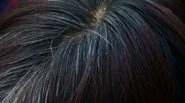 痘痘生长的四个阶段及去除方法,痘痘的防治方法有哪些