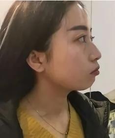 鐭笅宸存樉骞磋交涓暱鍙戦珮灞傛,鐭笅宸存樉鍦熷悧