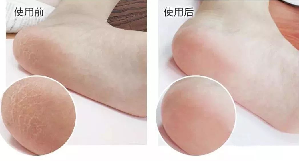 王子文拍照姿势,王子文惊艳泼辣写真