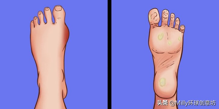 为什么随着年龄增长脚变大,为什么成年了脚还在长大