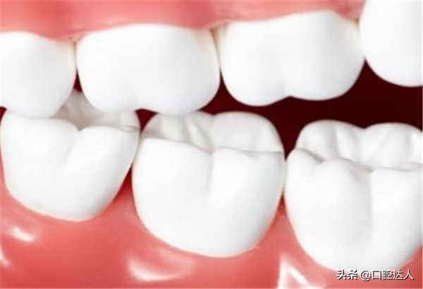 补过的牙几年后突然又疼了怎么治,补了几年的牙突然疼痛要如何解决