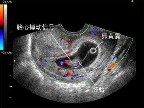 胎儿健康程度做什么检查,怎样能看出胎儿是否健康