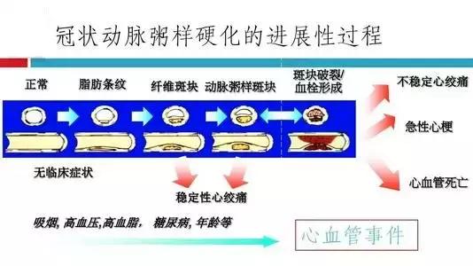 血管斑块吃什么可以消除,血管斑块饮食注意些什么