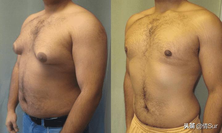 当你的胸比女朋友还大的时候,就要引起注意了……