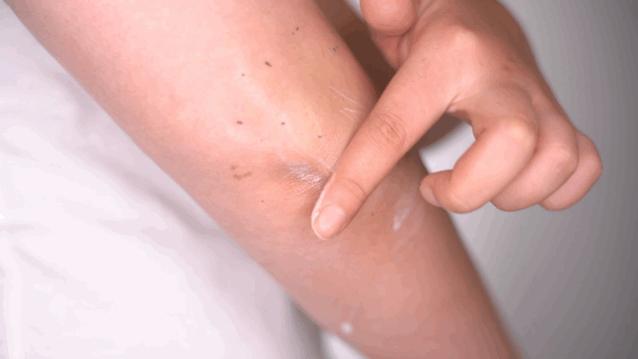 长黑头VS不长黑头差距这么大?精致女孩如何绕过黑头这道坎?